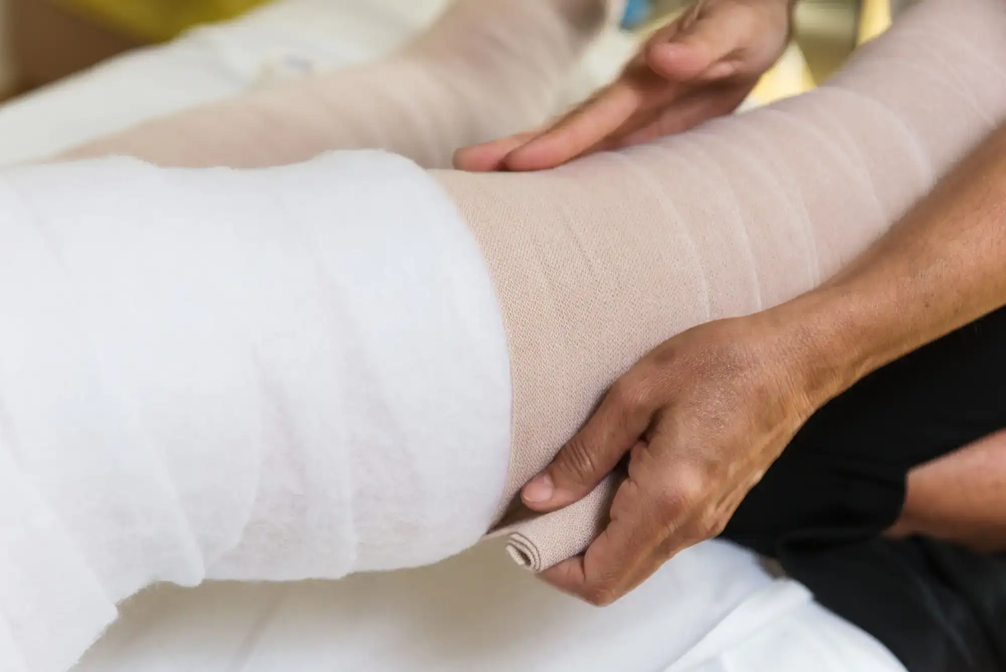 A person carefully wraps a medical bandage around another&rsquo;s partially bandaged injured leg for first aid.