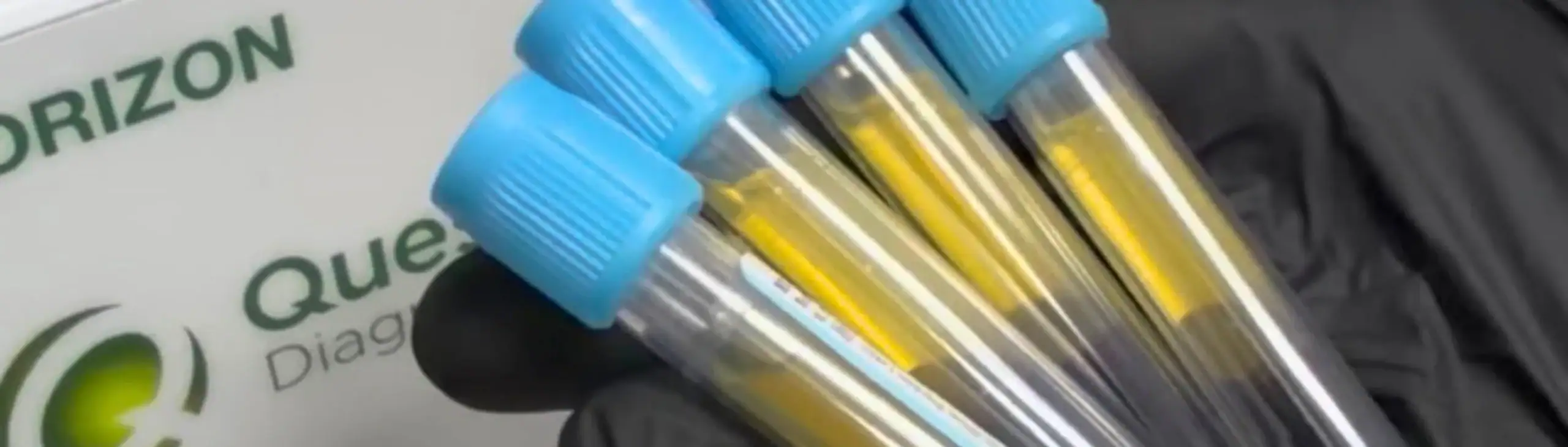 A gloved hand holds four blood sample tubes with blue caps, with a medical logo visible in the background.
